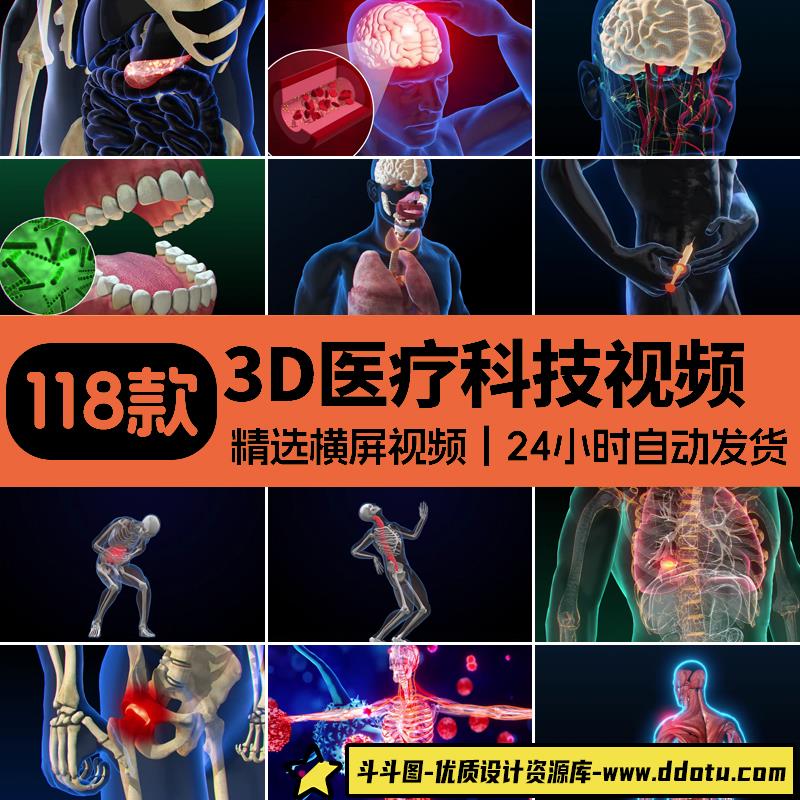 医疗3D科技健康疾病三维大脑骨骼人体器官医学动画演示片视频素材-斗斗图